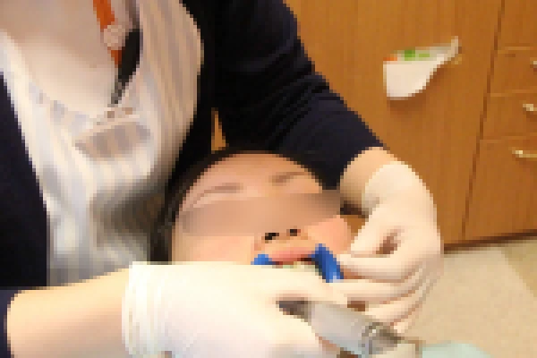 歯の表面をクリーニングします。